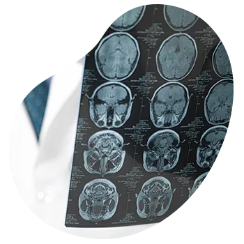 Consulta de neurología