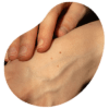 anatomiapatologicadermica