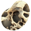 densitometriaosea