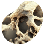 densitometriaosea