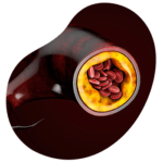 ecografia doppler