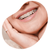 radiografia panoramica dental