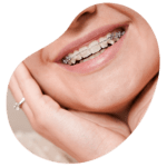 radiografia panoramica dental