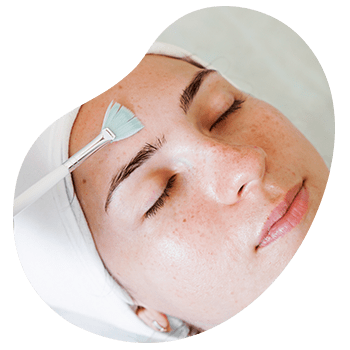 tratamientodepeelingfacial